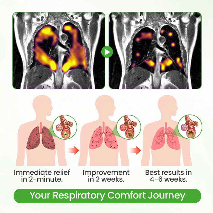 🎁 Limited time offer up to 80% off NESLEMY® HerbaAir Mullein Lung Purifier!