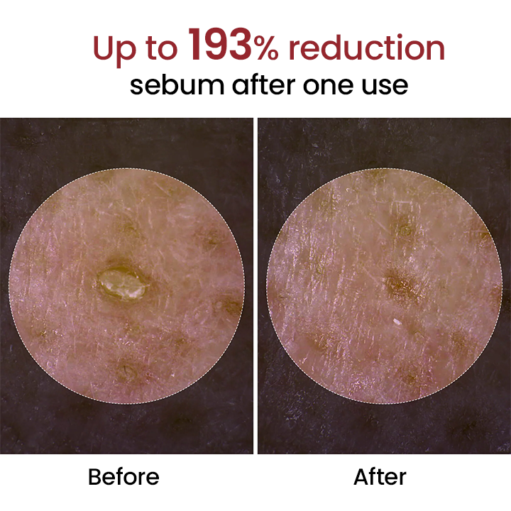 Grunsify® Peel Show Glow Black Rice Ampoule