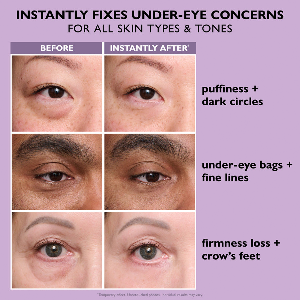 🔥New product launch, 80% discount ,Visibly Diminish Wrinkles for a Smoother, Firmer Finish ✨